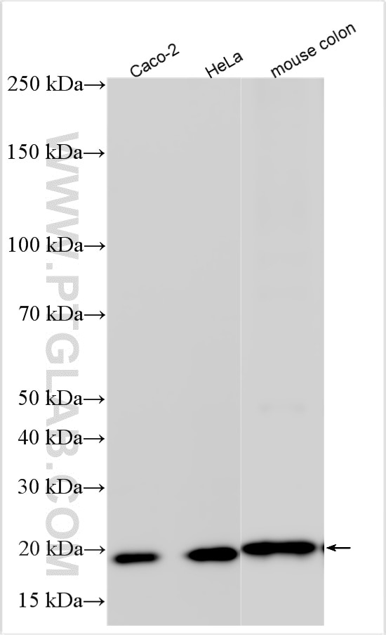WB analysis using 15354-1-AP Western Blot (WB) analysis of various lysates using MYL9 Polyclonal antibody (15354-1-AP)