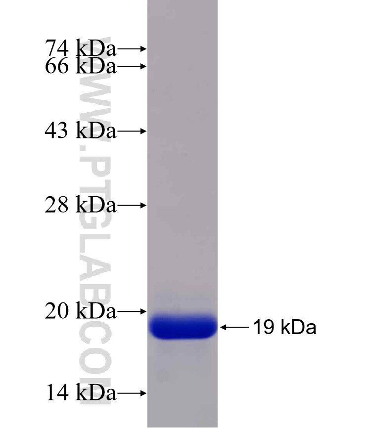 MYL9 fusion protein Ag7636 SDS-PAGE