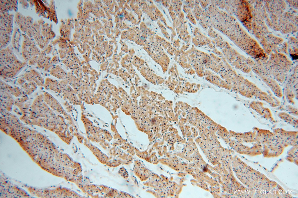 Immunohistochemistry (IHC) staining of human heart tissue using MYLIP Polyclonal antibody (15455-1-AP)