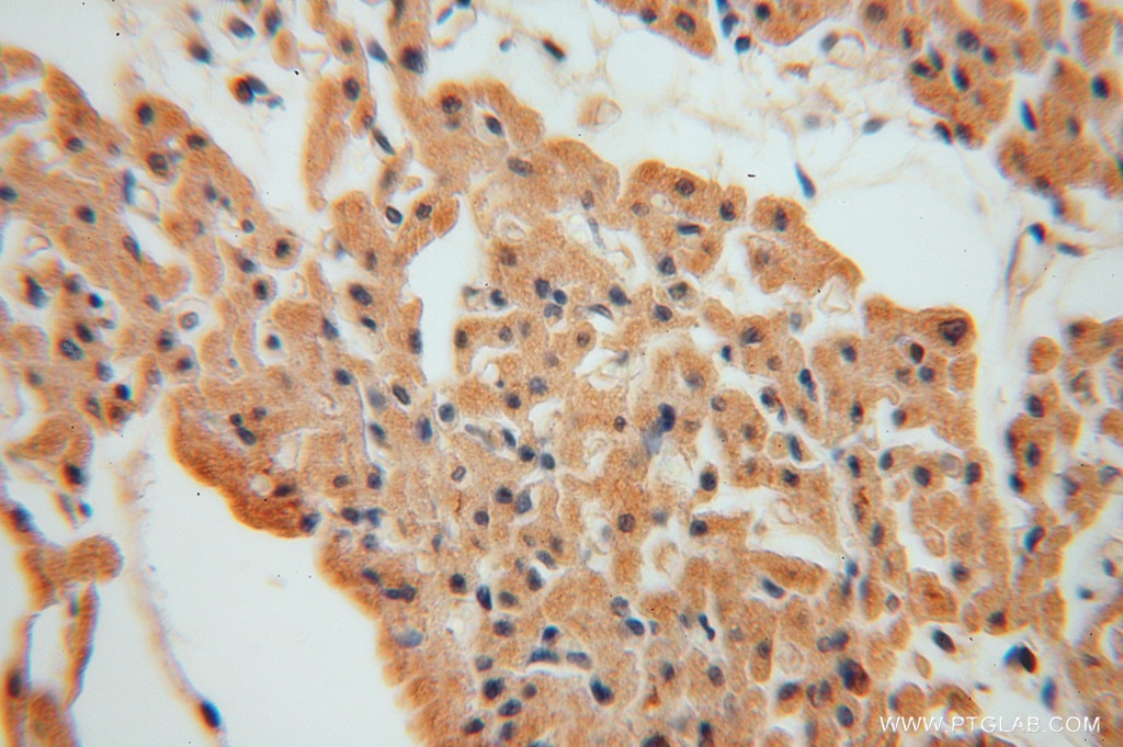 Immunohistochemistry (IHC) staining of human heart tissue using MYLIP Polyclonal antibody (15455-1-AP)