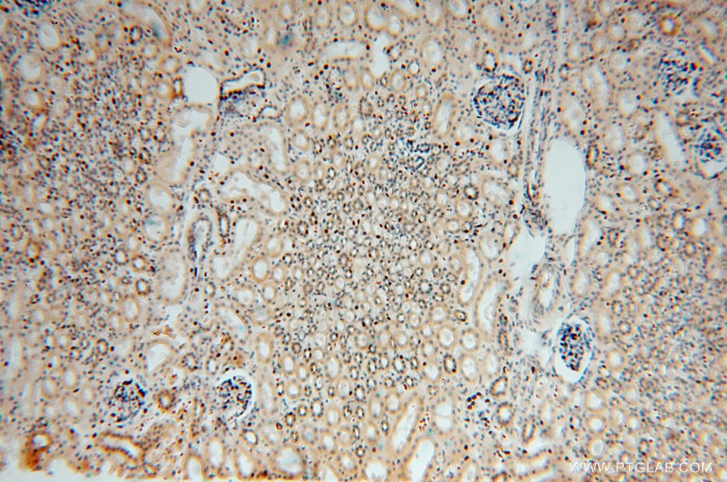 IHC staining of human kidney using 15455-1-AP