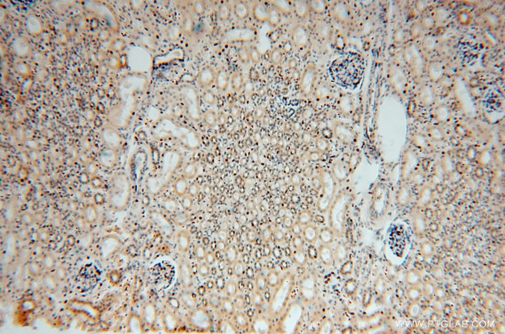 Immunohistochemistry (IHC) staining of human kidney tissue using MYLIP Polyclonal antibody (15455-1-AP)