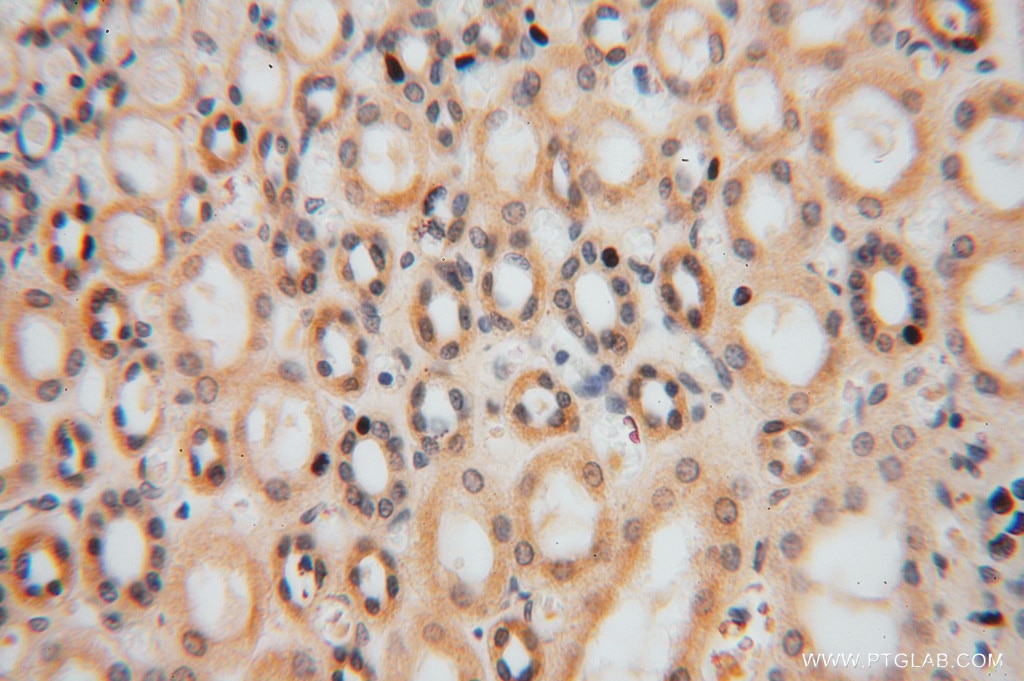 Immunohistochemistry (IHC) staining of human kidney tissue using MYLIP Polyclonal antibody (15455-1-AP)