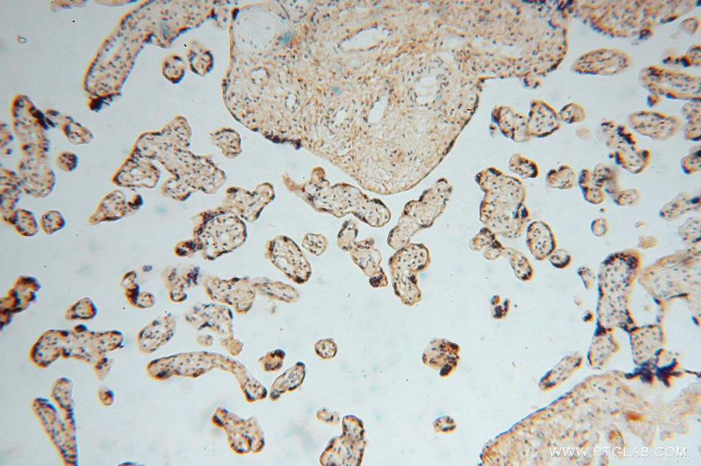 Immunohistochemistry (IHC) staining of human placenta tissue using MYLIP Polyclonal antibody (15455-1-AP)