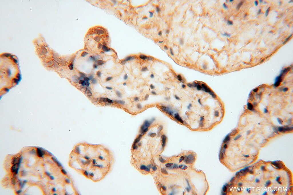 Immunohistochemistry (IHC) staining of human placenta tissue using MYLIP Polyclonal antibody (15455-1-AP)