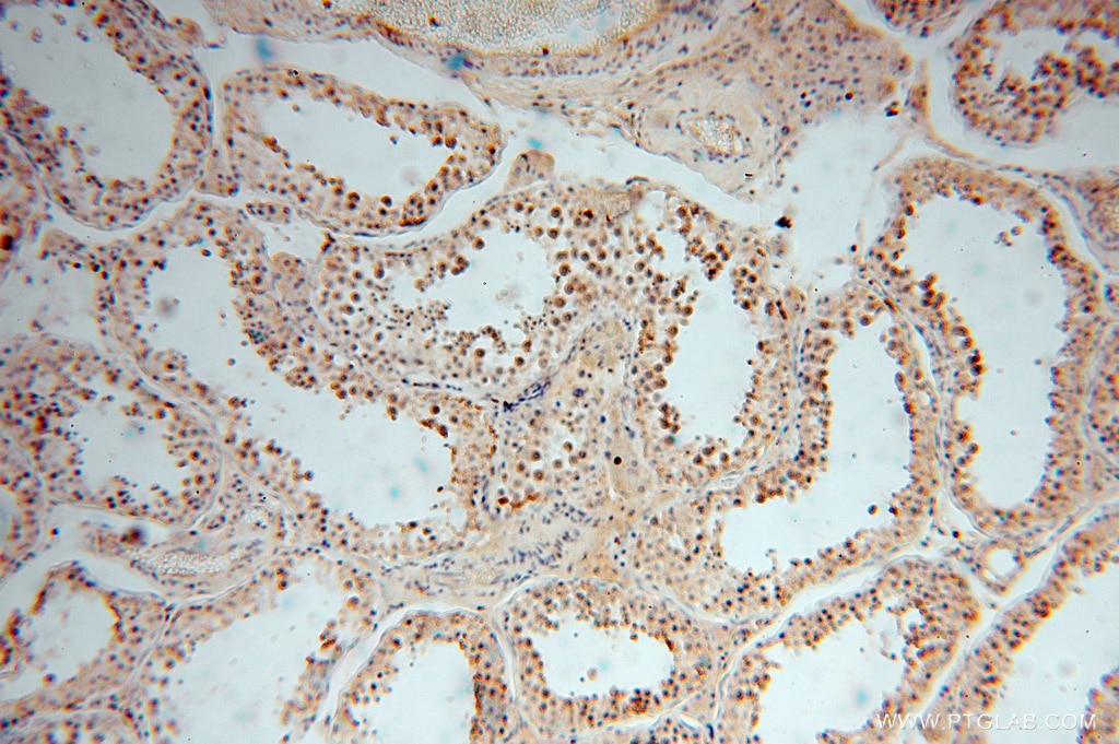 Immunohistochemistry (IHC) staining of human testis tissue using MYLIP Polyclonal antibody (15455-1-AP)