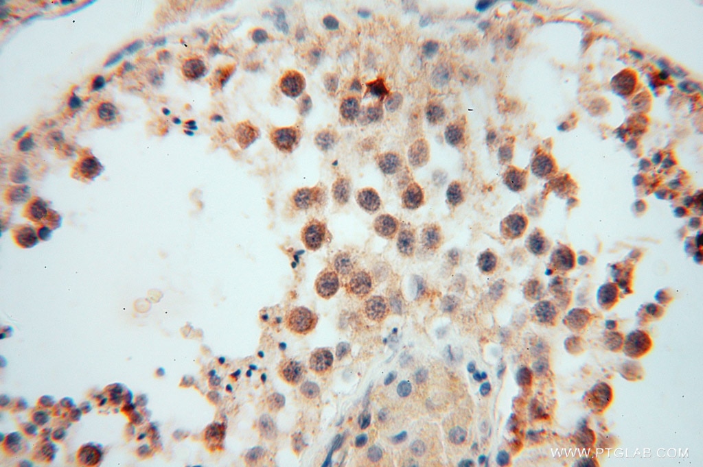 Immunohistochemistry (IHC) staining of human testis tissue using MYLIP Polyclonal antibody (15455-1-AP)