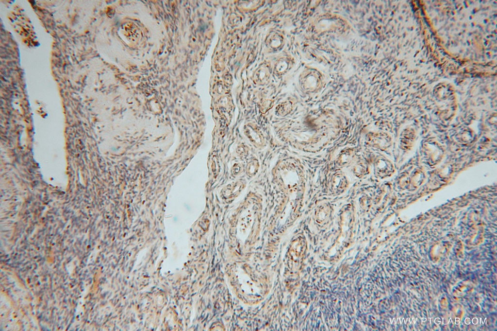 Immunohistochemistry (IHC) staining of human skin tissue using MYLIP Polyclonal antibody (15455-1-AP)