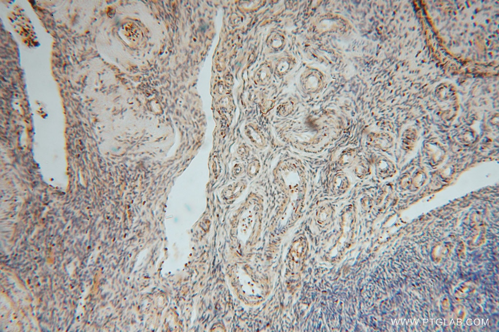 IHC staining of human skin using 15455-1-AP