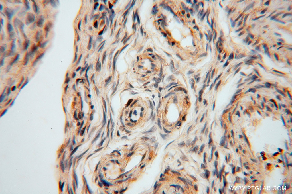 Immunohistochemistry (IHC) staining of human skin tissue using MYLIP Polyclonal antibody (15455-1-AP)