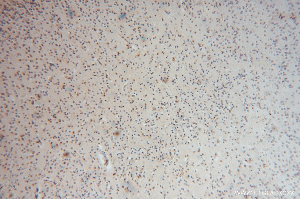 IHC staining of human brain using 15455-1-AP