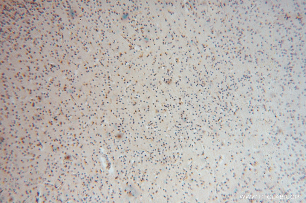 Immunohistochemistry (IHC) staining of human brain tissue using MYLIP Polyclonal antibody (15455-1-AP)