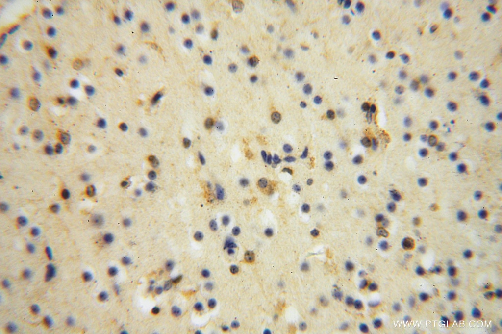Immunohistochemistry (IHC) staining of human brain tissue using MYLIP Polyclonal antibody (15455-1-AP)
