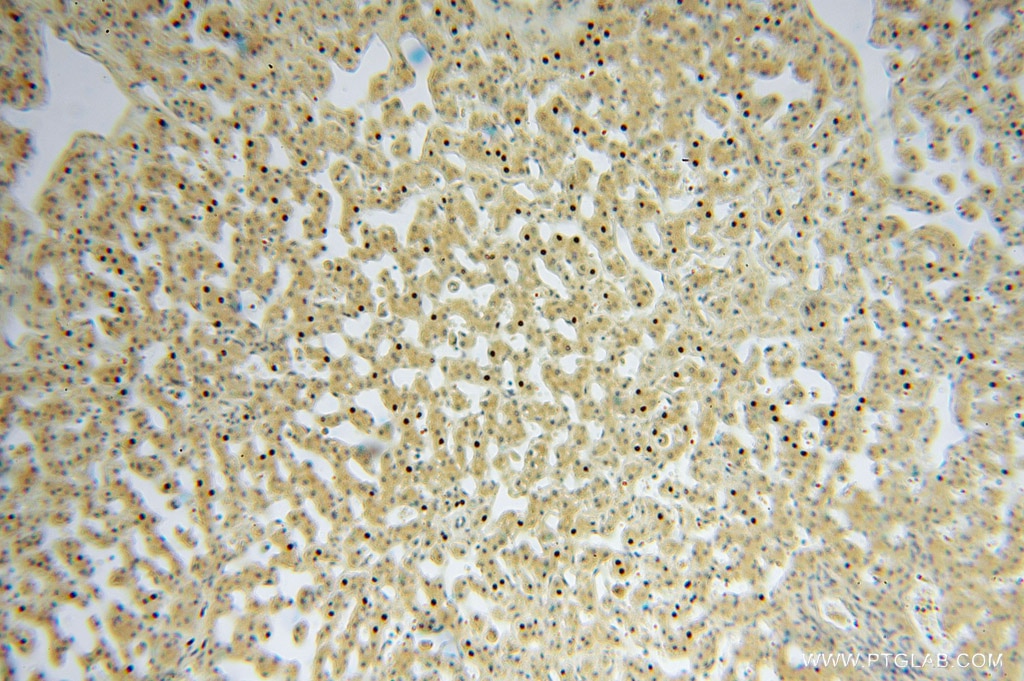 Immunohistochemistry (IHC) staining of human liver tissue using MYLIP Polyclonal antibody (15455-1-AP)
