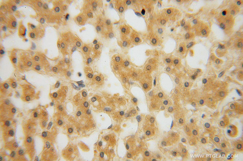 Immunohistochemistry (IHC) staining of human liver tissue using MYLIP Polyclonal antibody (15455-1-AP)