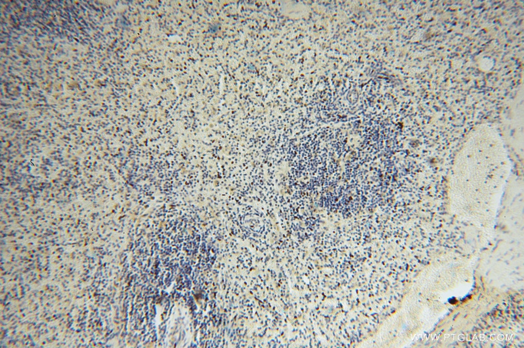 IHC staining of human spleen using 15455-1-AP