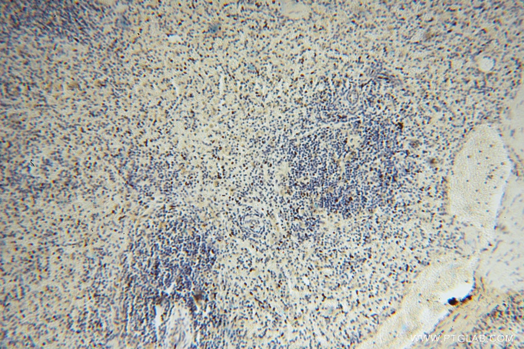 Immunohistochemistry (IHC) staining of human spleen tissue using MYLIP Polyclonal antibody (15455-1-AP)