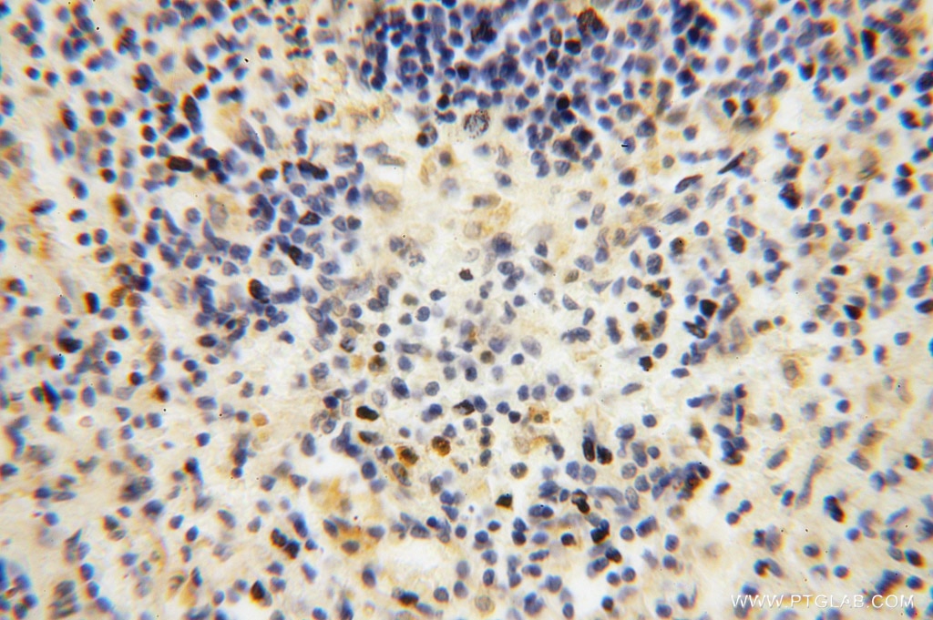 Immunohistochemistry (IHC) staining of human spleen tissue using MYLIP Polyclonal antibody (15455-1-AP)