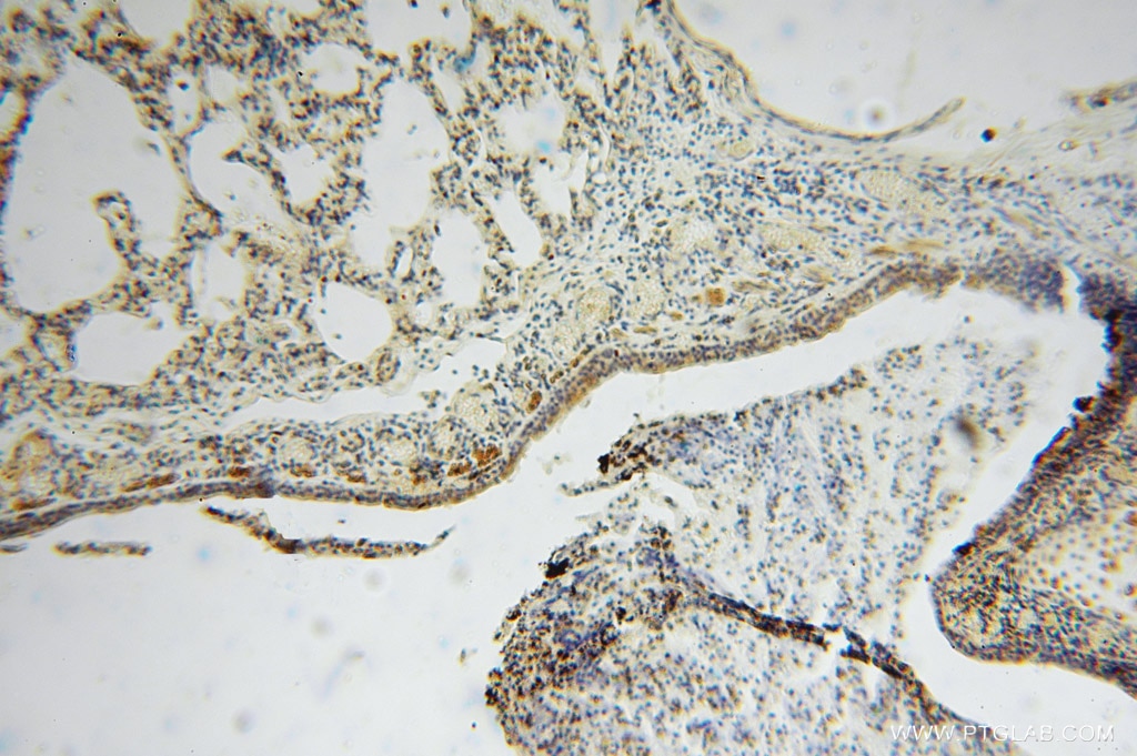 Immunohistochemistry (IHC) staining of human lung tissue using MYLIP Polyclonal antibody (15455-1-AP)