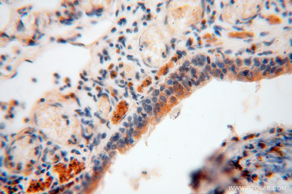 Immunohistochemistry (IHC) staining of human lung tissue using MYLIP Polyclonal antibody (15455-1-AP)