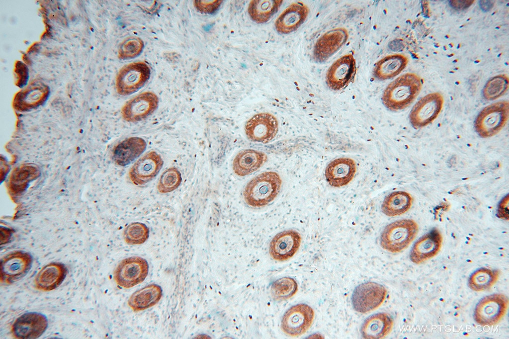Immunohistochemistry (IHC) staining of human ovary tissue using MYLIP Polyclonal antibody (15455-1-AP)