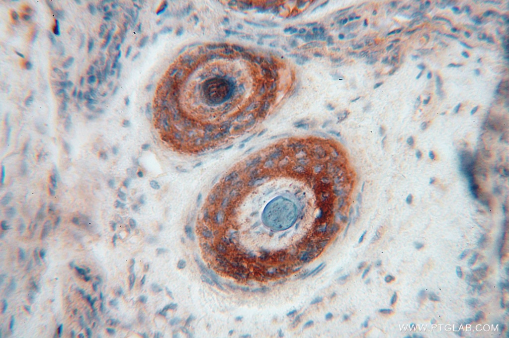 Immunohistochemistry (IHC) staining of human ovary tissue using MYLIP Polyclonal antibody (15455-1-AP)