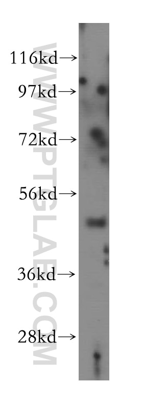 Western Blot (WB) analysis of human cerebellum tissue using MYLIP Polyclonal antibody (15455-1-AP)