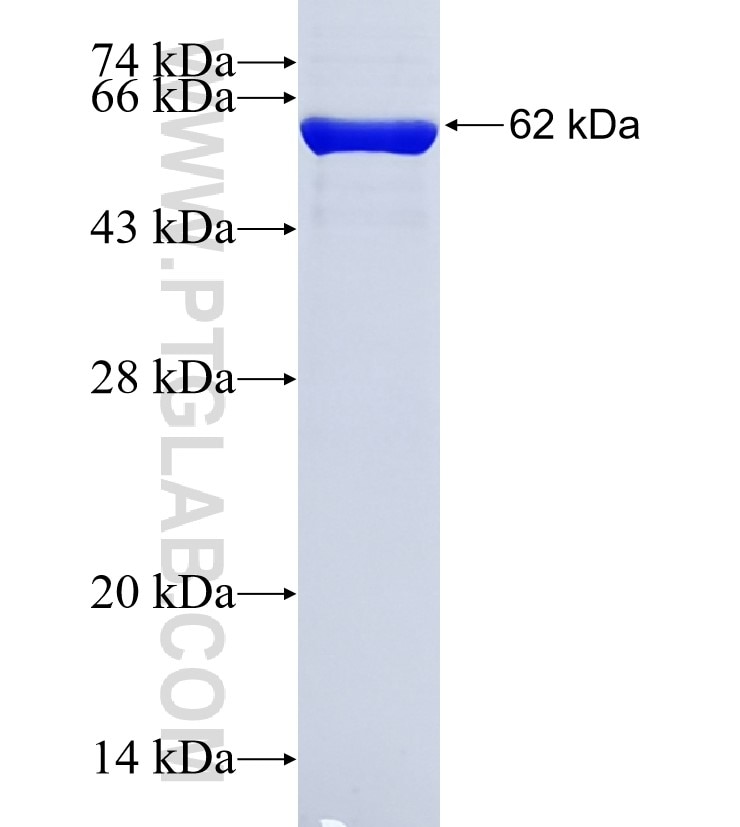 MYLIP fusion protein Ag7720 SDS-PAGE