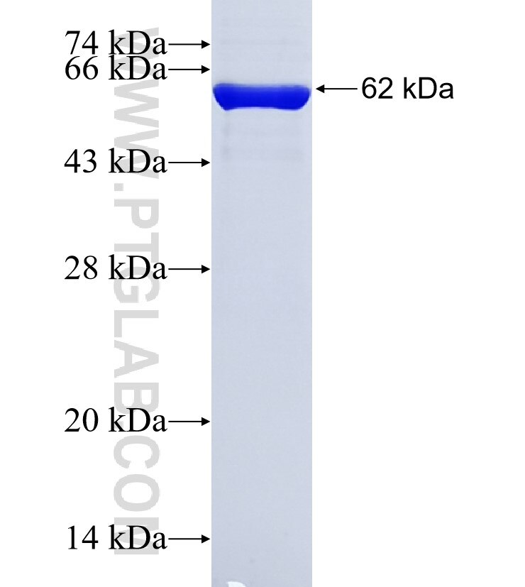 MYLIP fusion protein Ag7720 SDS-PAGE