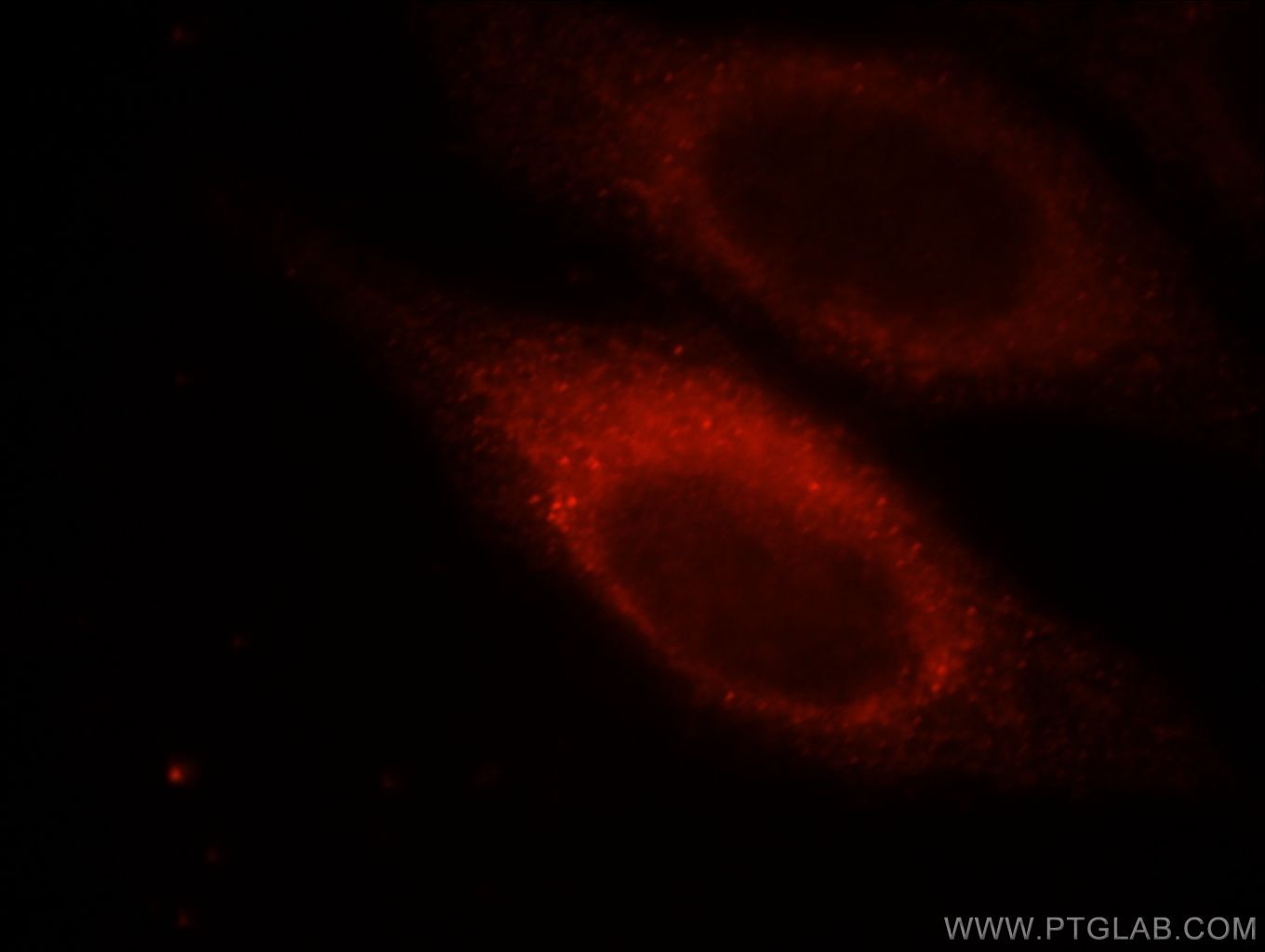 Immunofluorescence (IF) / fluorescent staining of HepG2 cells using MYLK Polyclonal antibody (21642-1-AP)