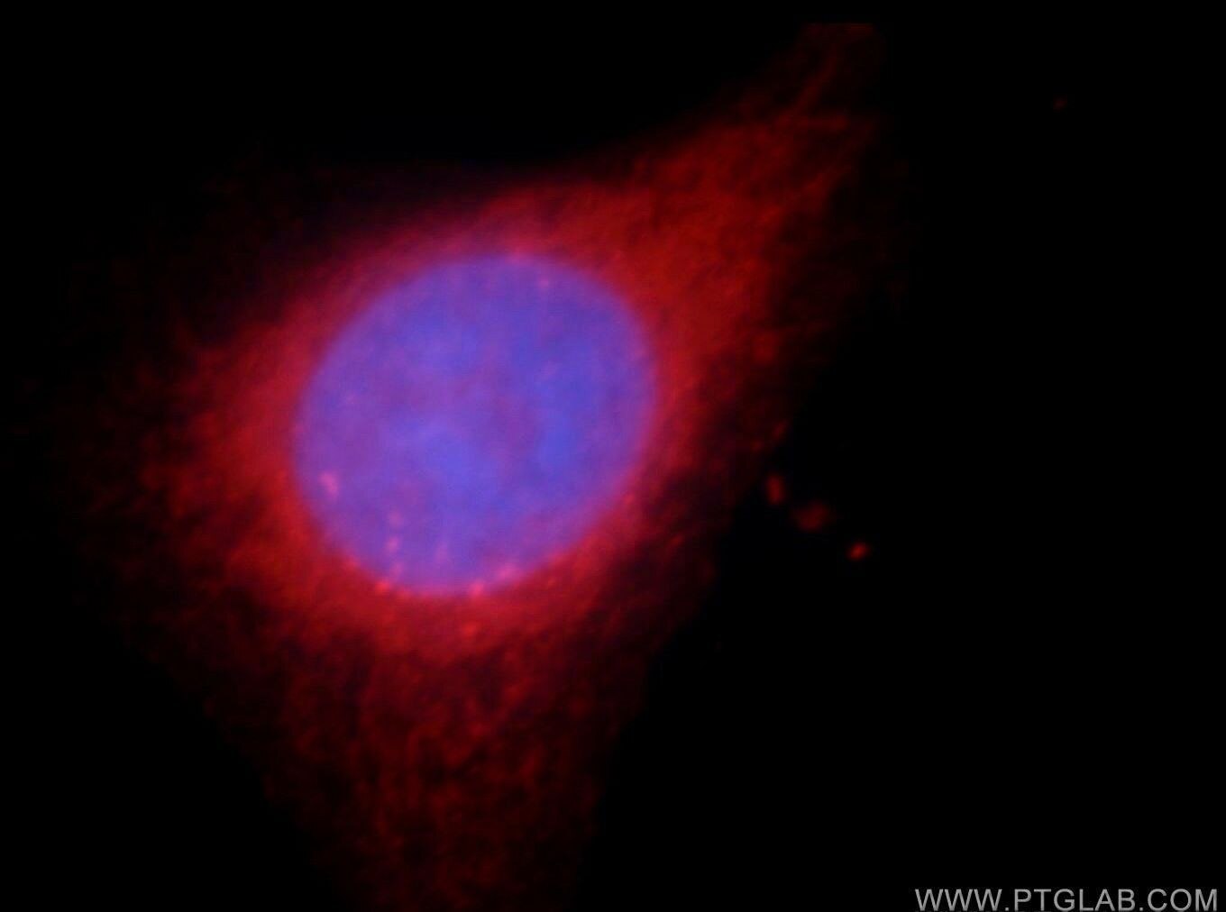 Immunofluorescence (IF) / fluorescent staining of HeLa cells using MYLK Polyclonal antibody (21642-1-AP)