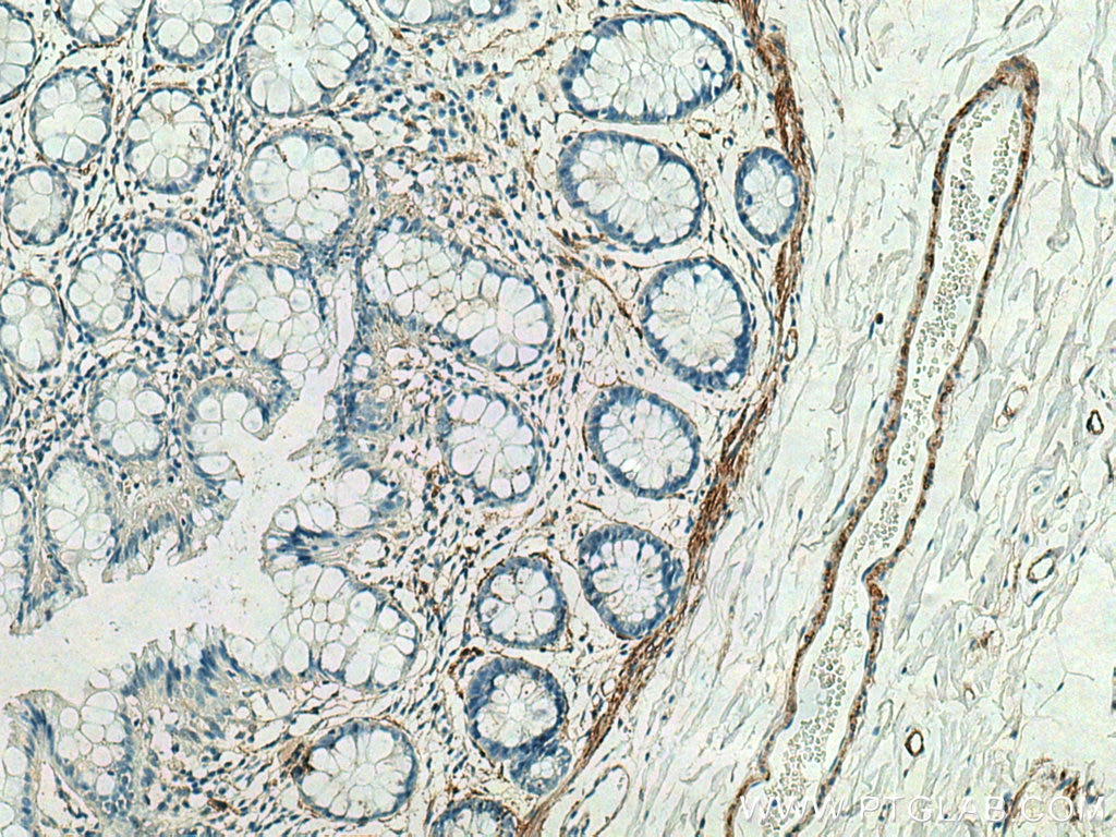 Immunohistochemistry (IHC) staining of human colon tissue using MYLK Polyclonal antibody (21642-1-AP)