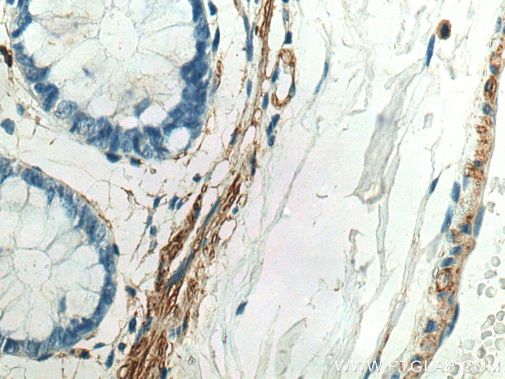 Immunohistochemistry (IHC) staining of human colon tissue using MYLK Polyclonal antibody (21642-1-AP)
