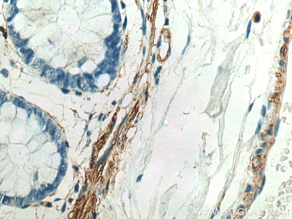 IHC staining of human colon using 21642-1-AP