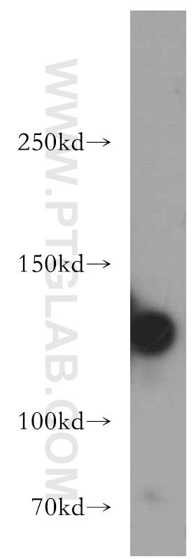 Western Blot (WB) analysis of mouse uterus tissue using MYLK Polyclonal antibody (21642-1-AP)