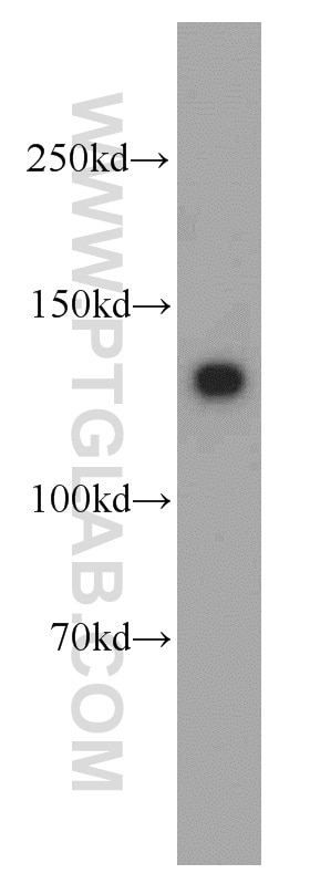 Western Blot (WB) analysis of mouse uterus tissue using MYLK Polyclonal antibody (21642-1-AP)