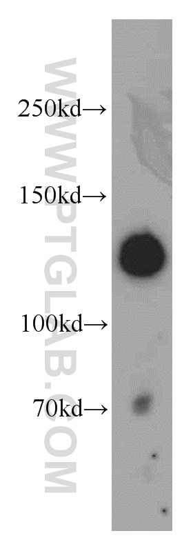 Western Blot (WB) analysis of mouse large intestine tissue using MYLK Polyclonal antibody (21642-1-AP)