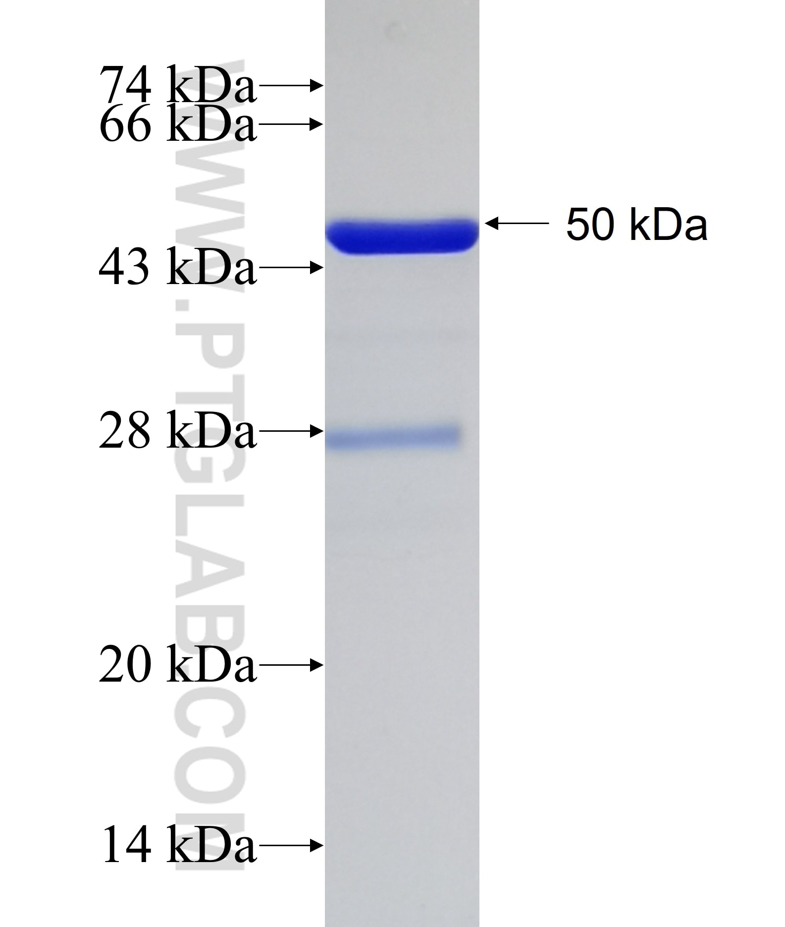 MYLK fusion protein Ag16306 SDS-PAGE