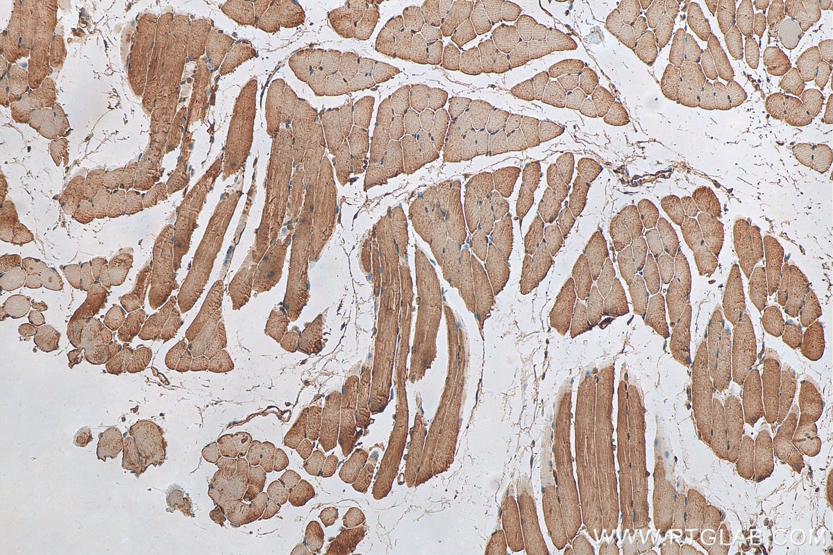 Immunohistochemistry (IHC) staining of mouse skeletal muscle tissue using MYLK2 Polyclonal antibody (21173-1-AP)