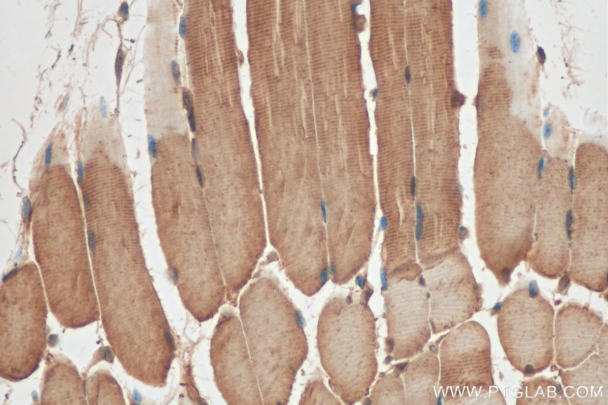 Immunohistochemistry (IHC) staining of mouse skeletal muscle tissue using MYLK2 Polyclonal antibody (21173-1-AP)