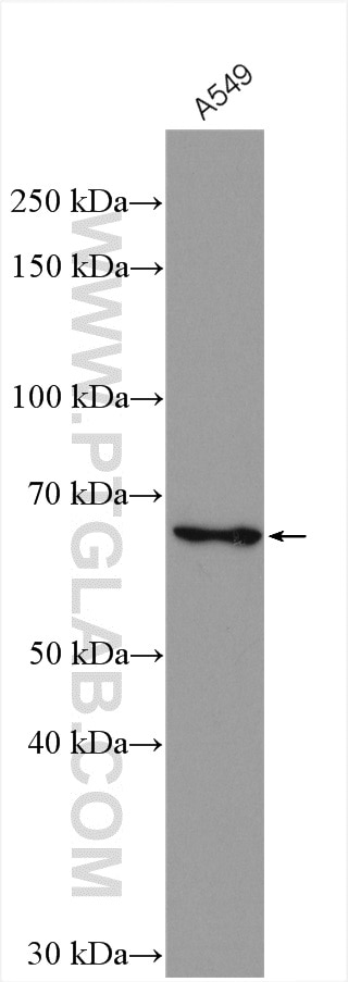 Western Blot (WB) analysis of various lysates using MYLK2 Polyclonal antibody (21173-1-AP)