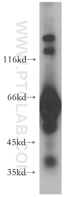 Western Blot (WB) analysis of human skeletal muscle tissue using MYLK2 Polyclonal antibody (21173-1-AP)