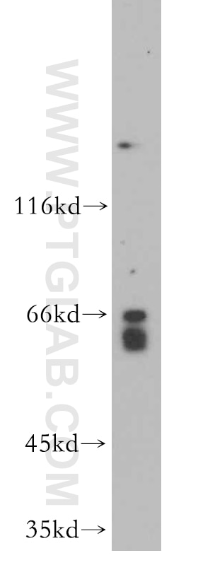 Western Blot (WB) analysis of Jurkat cells using MYLK2 Polyclonal antibody (21173-1-AP)