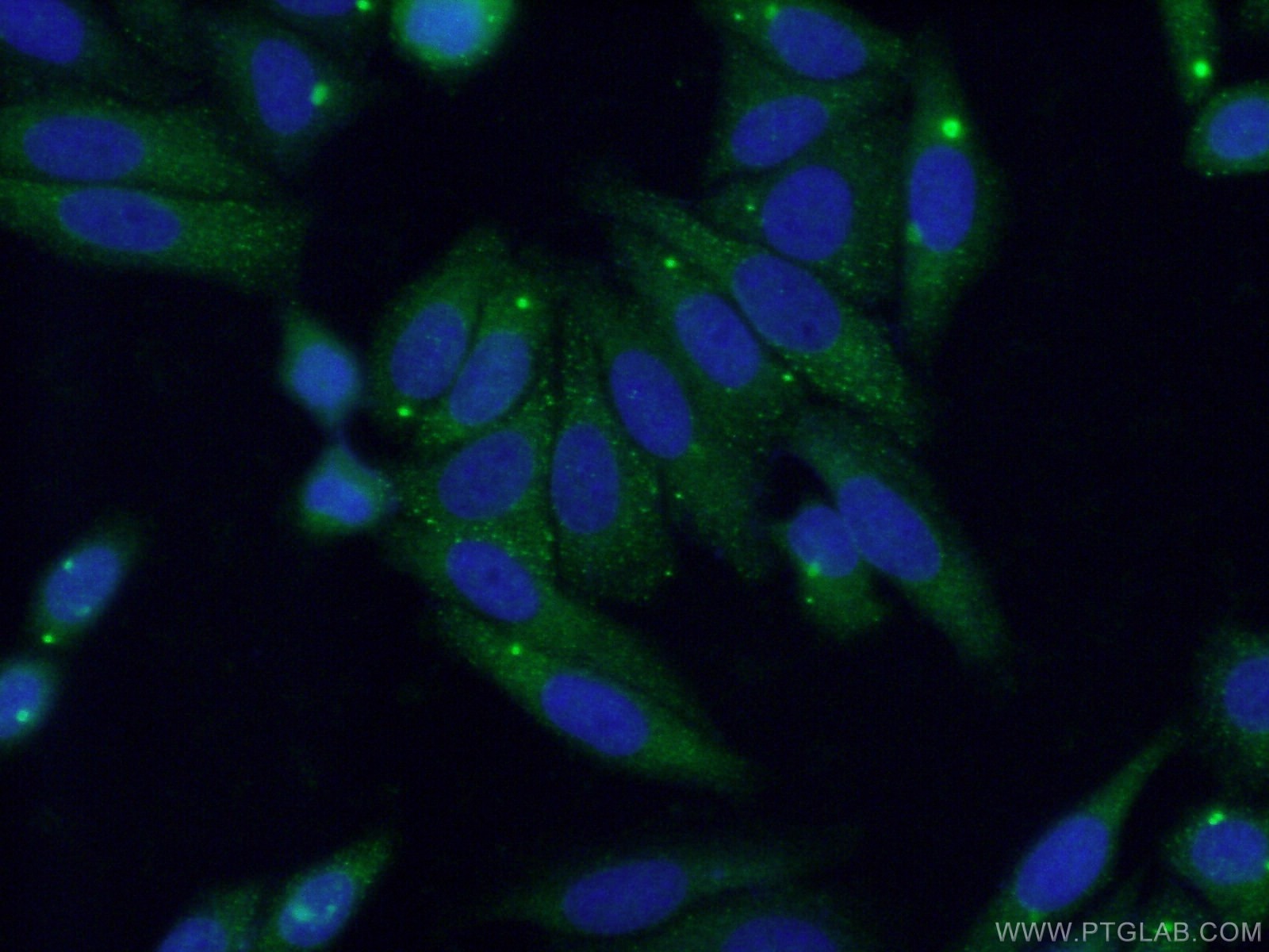 Immunofluorescence (IF) / fluorescent staining of HepG2 cells using MYLK3 Polyclonal antibody (21527-1-AP)
