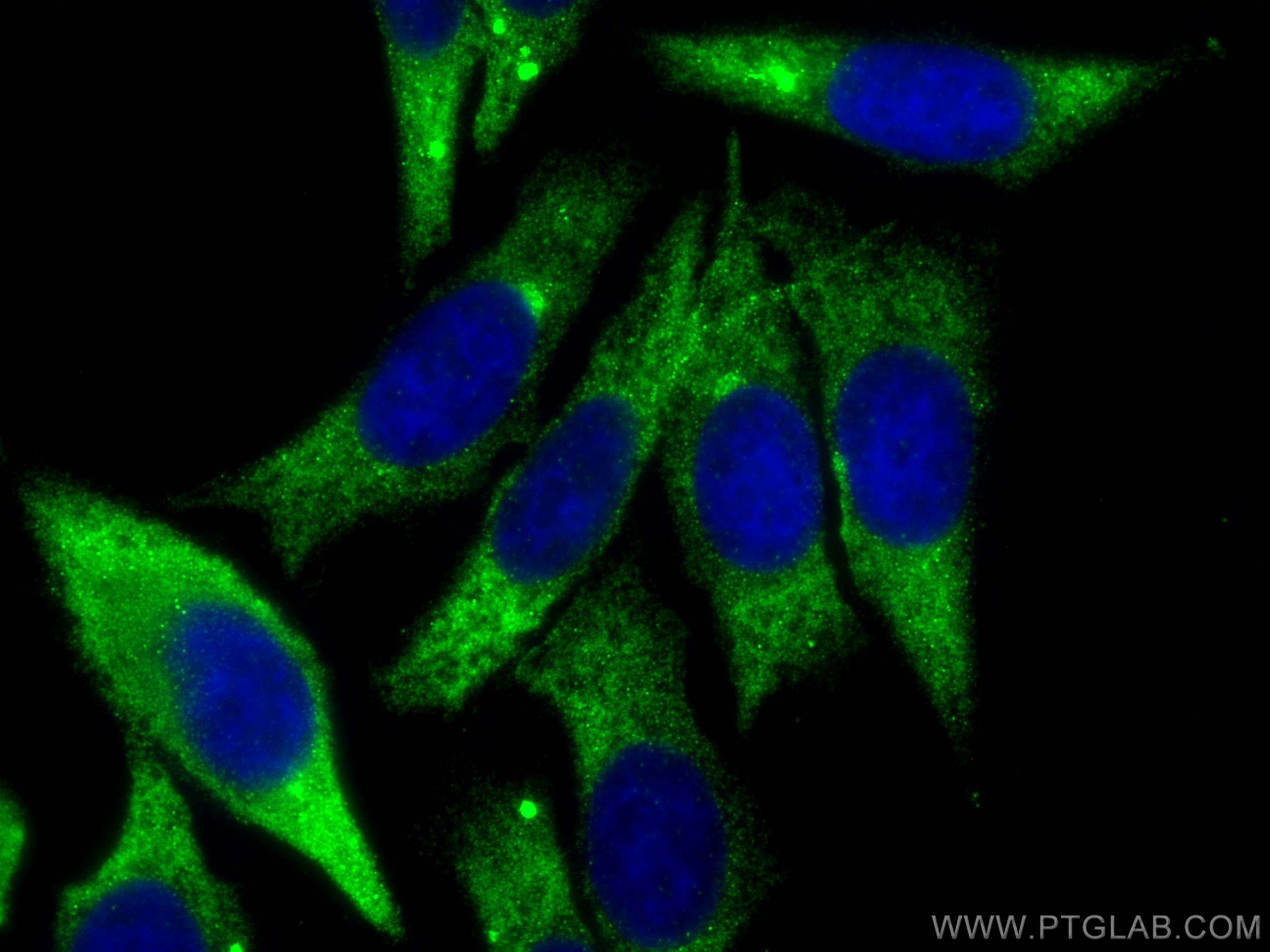 Immunofluorescence (IF) / fluorescent staining of HepG2 cells using MYLK3 Polyclonal antibody (21527-1-AP)
