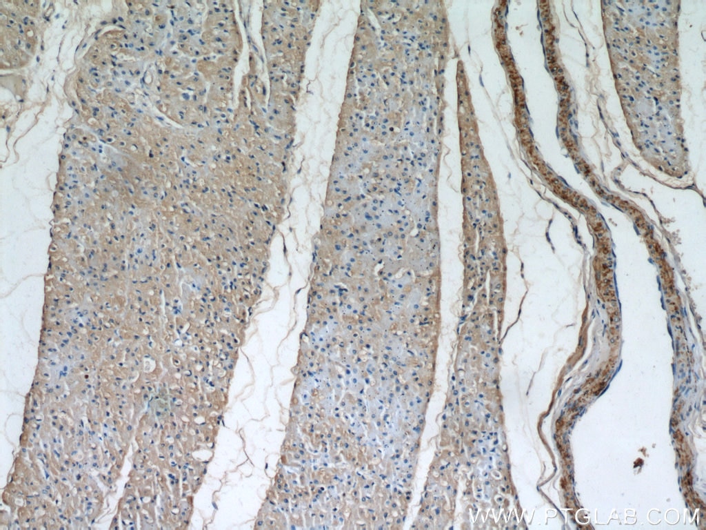 IHC staining of human heart using 21527-1-AP