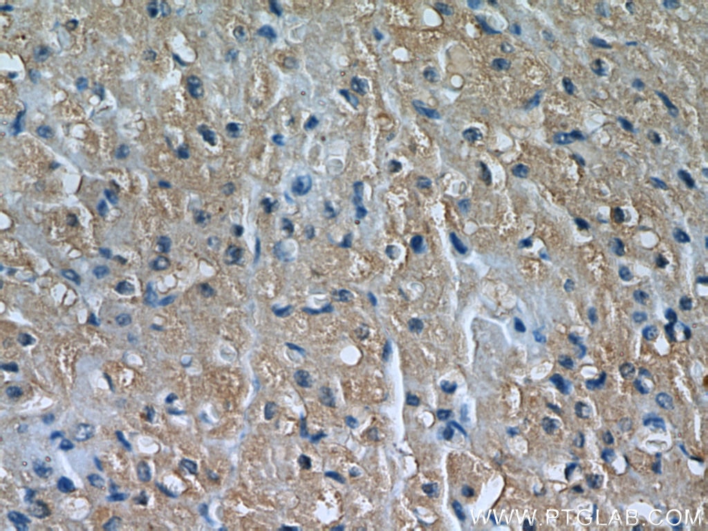 Immunohistochemistry (IHC) staining of human heart tissue using MYLK3 Polyclonal antibody (21527-1-AP)