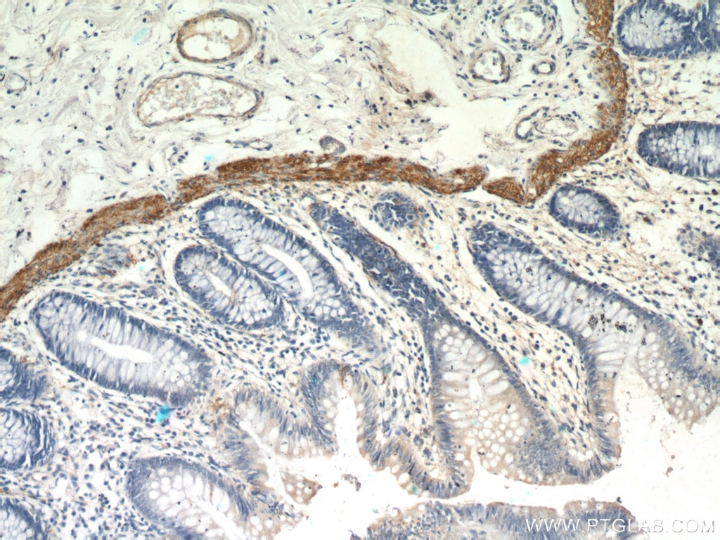 Immunohistochemistry (IHC) staining of human colon tissue using MYLK3 Polyclonal antibody (21527-1-AP)