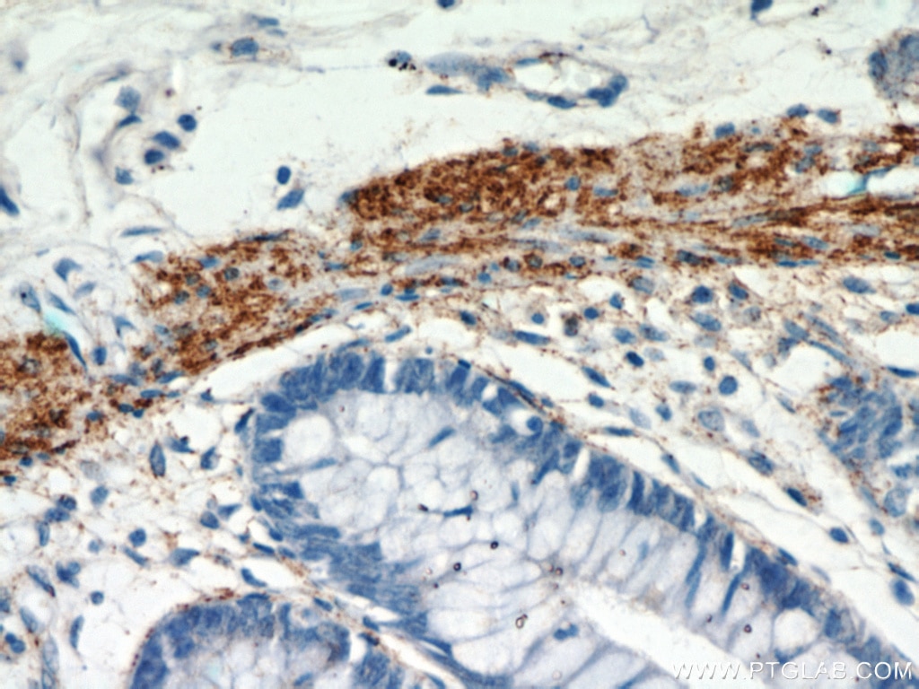 Immunohistochemistry (IHC) staining of human colon tissue using MYLK3 Polyclonal antibody (21527-1-AP)
