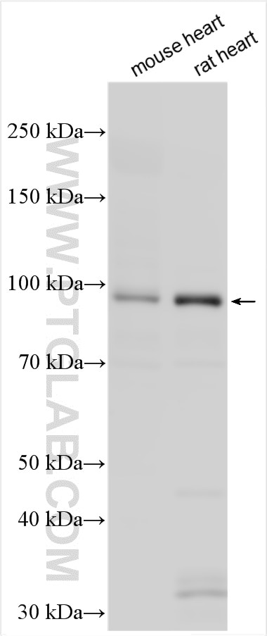 Western Blot (WB) analysis of various lysates using MYLK3 Polyclonal antibody (21527-1-AP)